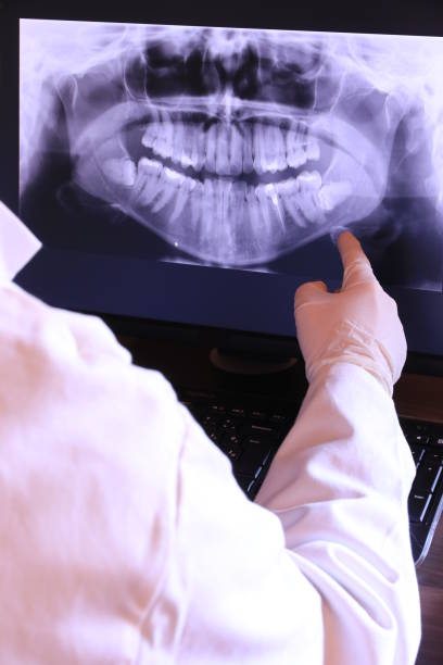 Best Emergency Wisdom Teeth Removal in Bellevue, MI